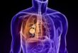Tumore al polmone: un nuovo farmaco per fermarne la crescita