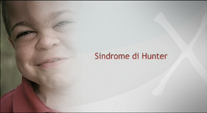 sindrome Hunter